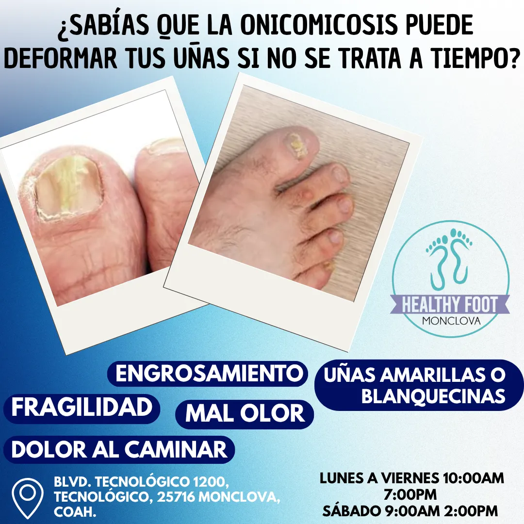 Diseño 145