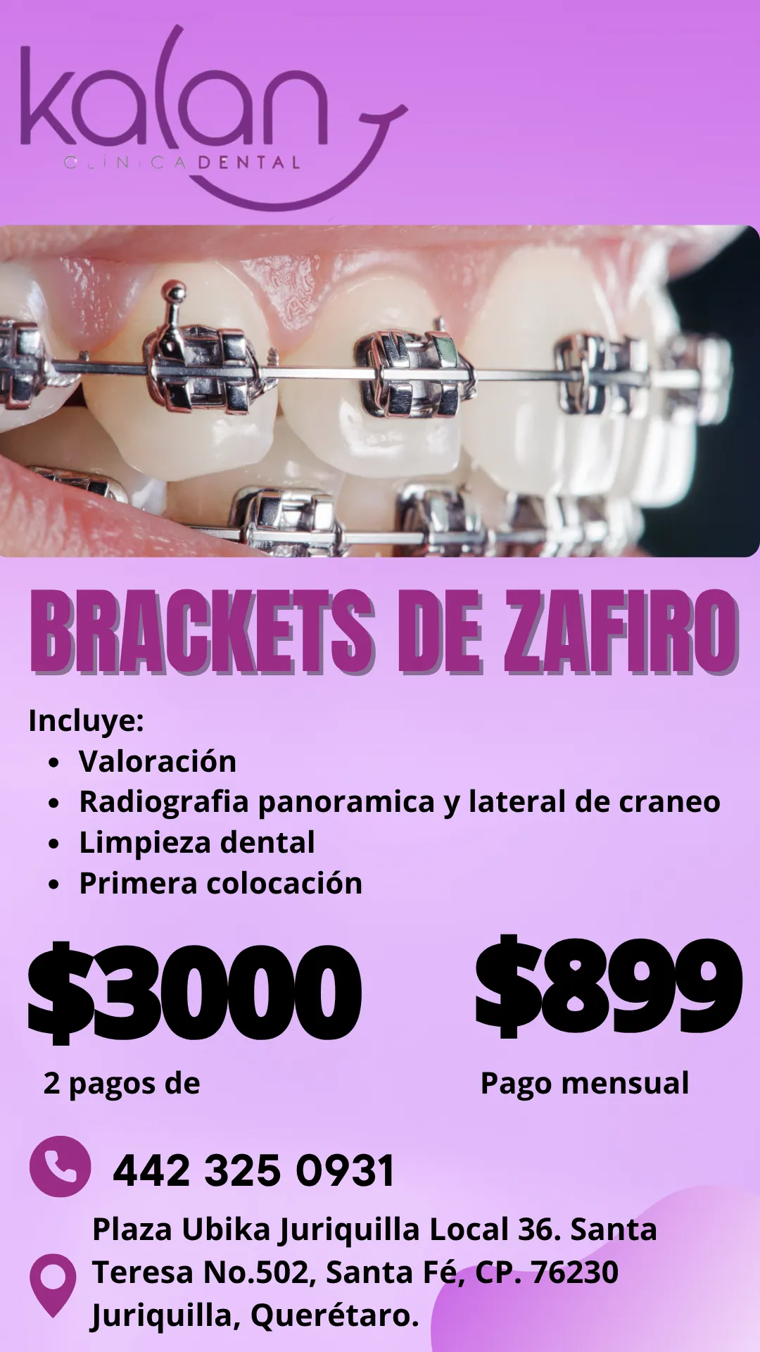 Diseño 79
