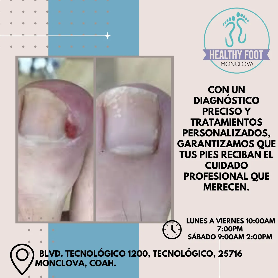 Diseño 26