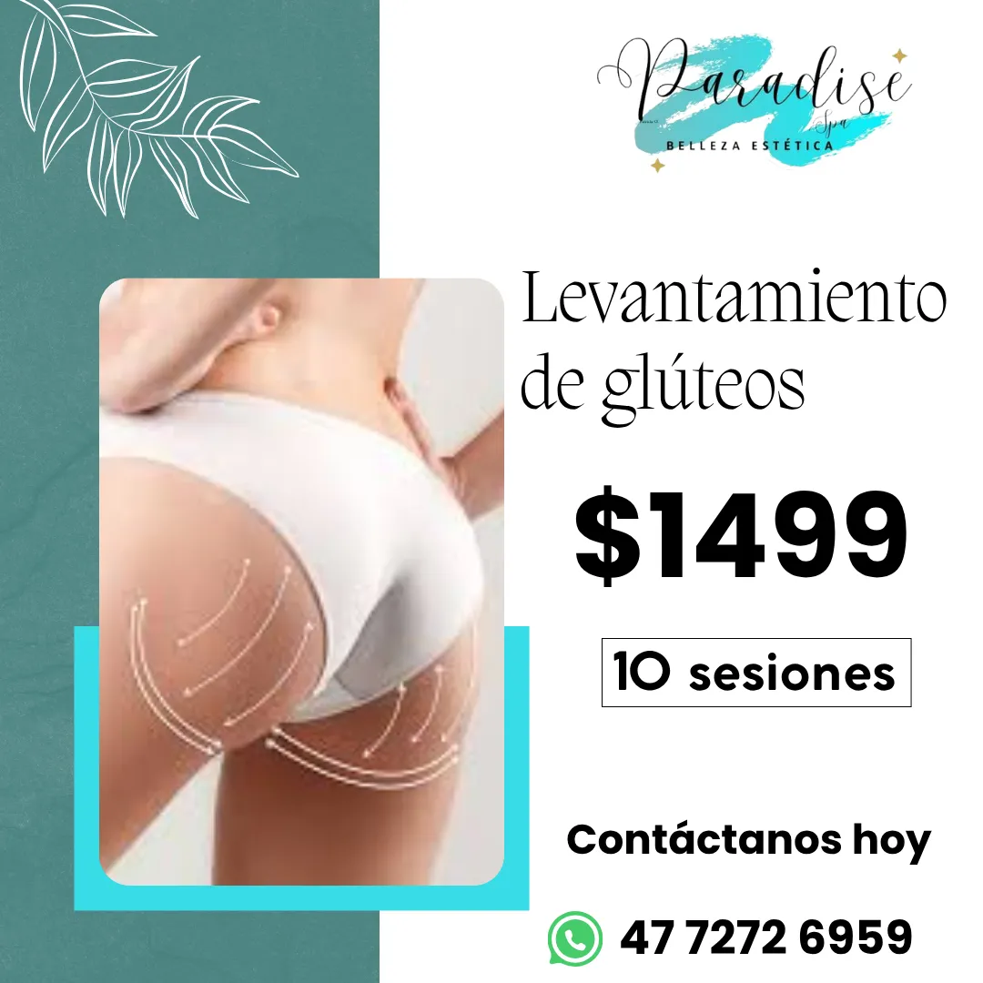 Diseño 79