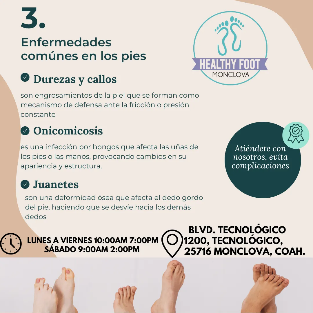 Diseño 30