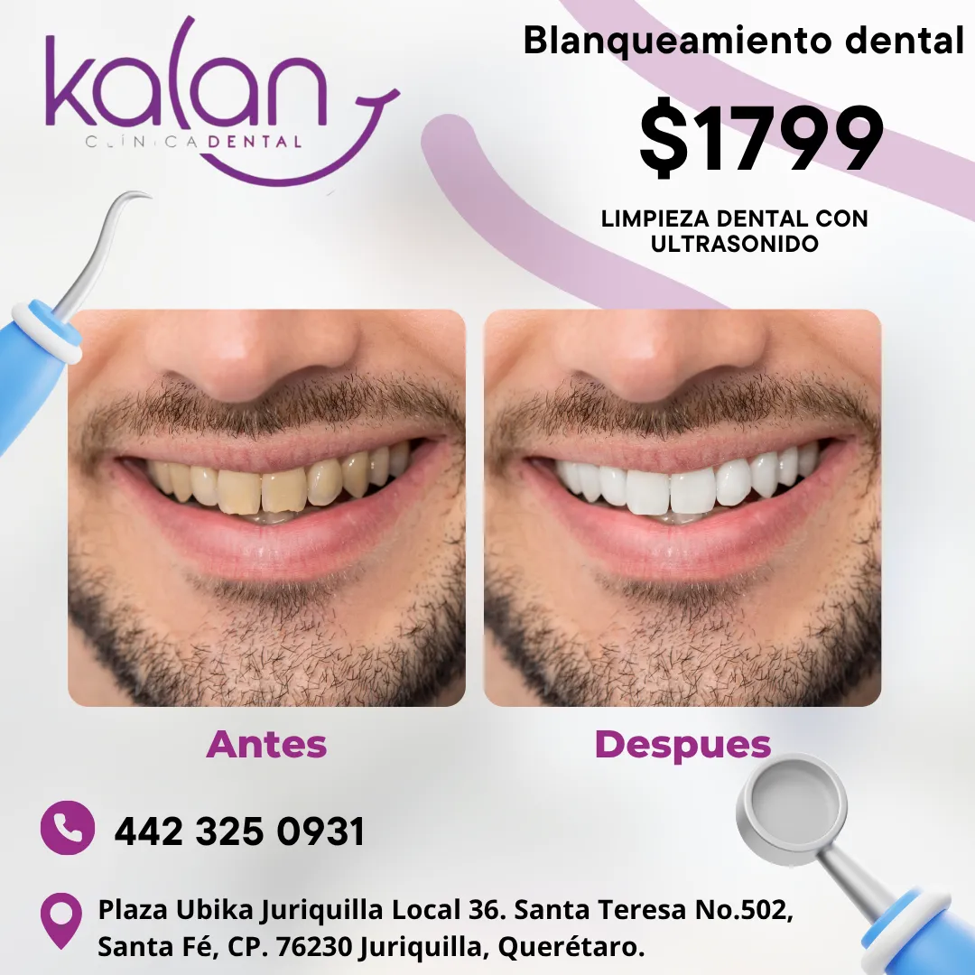 Diseño 56