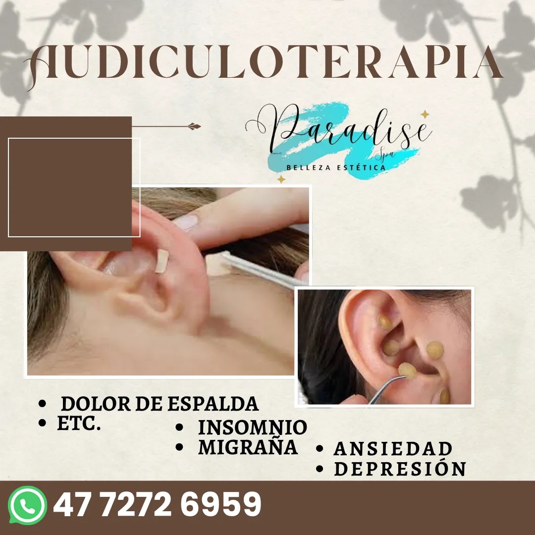 Diseño 2